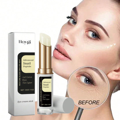 Revitalize Your Eyes with Snail Eye Cream: Anti-Wrinkle, Dark Circle Remover, and Puffiness Treatment Default Title Default Title-