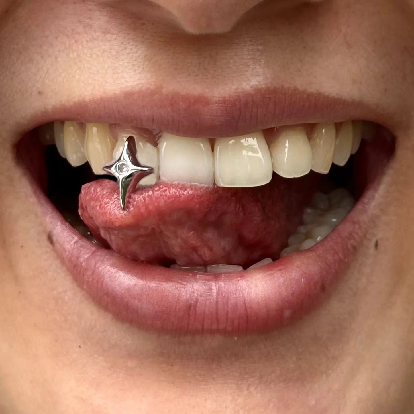 Cute CZ Stone Star Teeth Grillz Braces Gold Color Y2K Elegant Shiny Zircon Tooth Caps